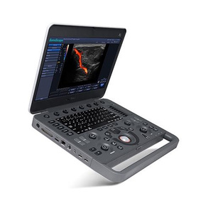 Sistema de Ultrasonido Doppler a Color Veterinario Portátil, Reutilizable y Duradero Sonoscape X5V Advanced para Diagnósticos Claros - Product Image 5