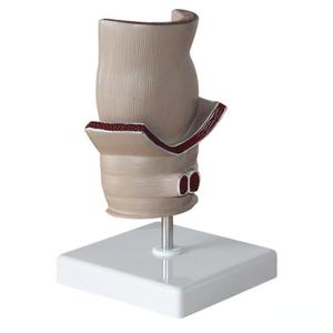 Medizinisches Lehr modell Rektales Pathologie modell für die Ausbildung von Prokto logie und Anatomie - Product Image 4