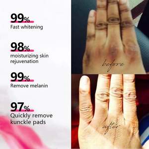 Crème éclaircissante pour les parties intimes, crème éclaircissante pour les <span class=keywords><strong>taches</strong></span> sombres du cou, des <span class=keywords><strong>jambes</strong></span>, des genoux, des coudes, des aisselles, crème éclaircissante pour la peau, directement de l'usine - Product Image 3