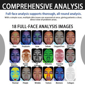 Novos Modelos <span class=keywords><strong>2026</strong></span>: Analisador de Pele Digital 3D Portátil Profissional, Máquina Scanner Facial Compacta - Product Image 2