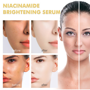 Mascarilla facial completa exfoliante, hidratante, que mejora la opacidad, limpieza suave, mascarilla para el cuidado de la piel - Product Image 6