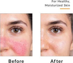 Оптовая продажа, новый травяной крем от экземы для детей, крем от псориаза, медицинское обслуживание - Product Image 3