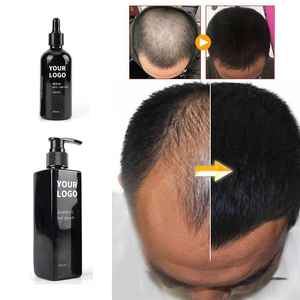 Nhà sản xuất dầu dưỡng tóc, dầu mọc tóc, dầu thầu dầu nhãn hiệu riêng, Batana, gừng hoang dã, biotin, hương thảo tự nhiên, hữu cơ, bán buôn - Product Image 2