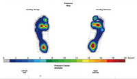 Système d'analyse de la marche avec tapis de pression plantaire haute précision, 6144 capteurs, mesure plantaire en temps réel à 300 ips, réadaptation clinique