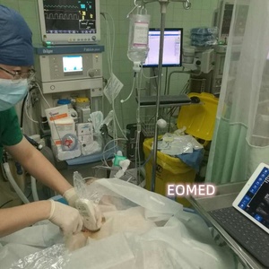 Factory Directly Supply Offer OEM&ODM&SDK Service for Wireless Ultrasound Probe Scanner - Product Image 5