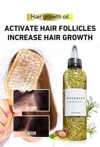 Minyak Mint perawatan rambut alami 100% Rosemary organik campuran herbal Label pribadi - Product Image 6
