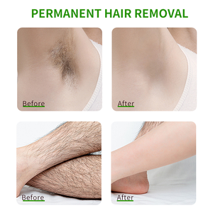 Crème dépilatoire douce hydratante et lissante pour zones intimes, jambes et aisselles, marque privée, 200g - Product Image 4