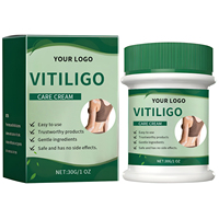 Krim Perawatan Vitiligo Logo Kustom Anda 30g, Cepat Menyerap, Lembut, Menyeimbangkan, Melembapkan, Meratakan Warna Kulit, Perawatan Efektif