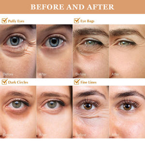 Patchs pour les yeux en hydrogel réparateurs, raffermissants et anti-rides à l'acide hyaluronique et au rétinol, hydratants, anti-rides, collagène - Product Image 2