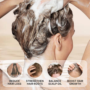 <span class=keywords><strong>Profesional</strong></span> Anti caída del cabello orgánico jengibre champú marcas crecimiento fortalece las raíces personalizado al por mayor <span class=keywords><strong>mejor</strong></span> champú para la caída del cabello - Product Image 2