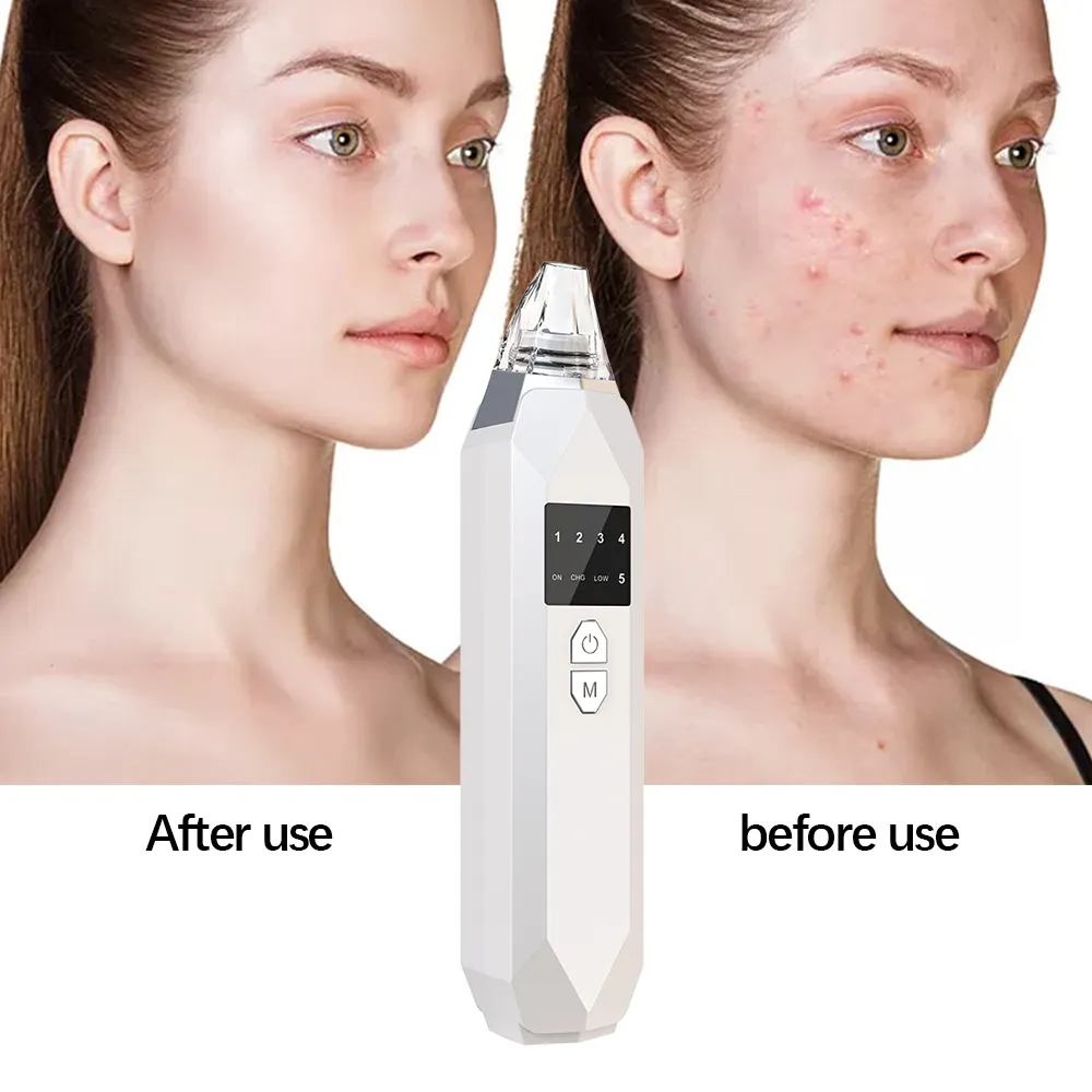 Pore Cleaner Blackhead Remover Vacuum Face Skin Care Suction Black Head Black Dots Blackheads Pimples Removal Deep Cleaning Tool