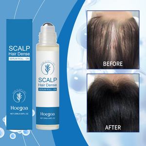 Tratamiento Capilar Profesional de Primera Calidad para Cabello Fino, con Romero, Nutritivo para el Cuero Cabelludo y Estimulante del Crecimiento, Marca Privada - Product Image 2