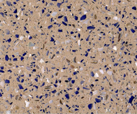 Plancher de Terrazzo Beige 300x300, carrelage de Terrazzo multicolore pour évier balcon australie