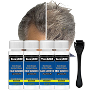 Huile capillaire nourrissante bio personnalisée pour la repousse des cheveux bouclés, formule à la biotine, traitement de croissance super rapide 5%