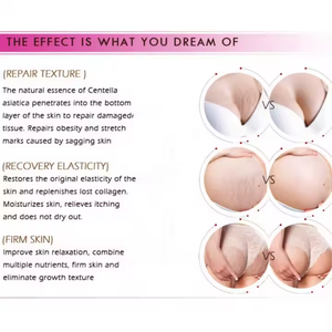 Crema Naturale per la Rimozione delle Smagliature in Gravidanza, Etichetta Privata OEM - Product Image 3
