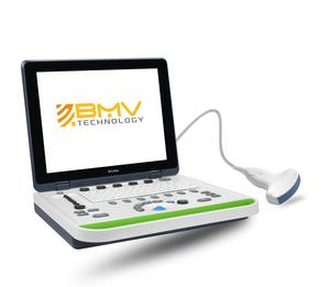 Máquina <span class=keywords><strong>Veterinaria</strong></span> BPU50, Ecógrafo Portátil Veterinario Económico, Utilizado para Escanear la Gestación de Animales - Product Image 3