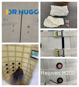 Cámara de Oxígeno Hiperbárico DR.HUGO Rejuven H200 Clinic, Cámara de Oxígeno Hiperbárico de Carcasa Blanda 2.0ATA, Cámara de Oxigenación Hiperbárica HBOT - Product Image 5