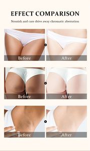 Starke und Wirksame Hautaufhellungscreme, die Stärkste Aufhellungscreme für Achseln und Intimbereich - Product Image 2