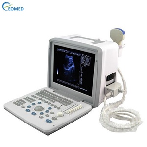 Équipement d'échographie médicale BW300, système d'échographie numérique complet - Product Image 4