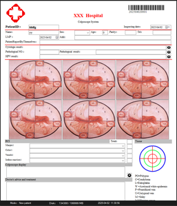 Colposcope numérique vidéo HD 1080P de haute définition Kernel Colposcopio <span class=keywords><strong>KN</strong></span> 2200A avec <span class=keywords><strong>filtre</strong></span> vert spécial à 4 niveaux - Product Image 5