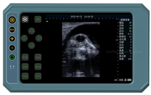 Karestar <span class=keywords><strong>K</strong></span>-H102A Günstiger Volldigitaler Veterinär-Tier-Scanner 12 Zoll Tragbares Ultraschall-Handgerät für Tiere CE-Zertifiziert - Product Image 4