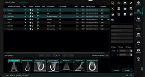 Careview เครื่องตรวจจับรังสีเอกซ์แบบ1500cw, แผงแบนดิจิตอลอุปกรณ์เสริมอุปกรณ์รังสีวิทยา - Product Image 6