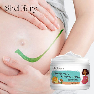 Tùy Chỉnh Tự Nhiên Mang Thai Mịn Căng Đánh Dấu Loại Bỏ Kem Chống-Căng Đánh Dấu Loại Bỏ Vết Sẹo Cho Cơ Thể OEM ODM Nhãn Hiệu Riêng - Product Image 1