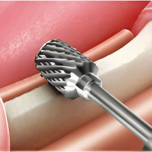 Đi Nụ cười nha khoa cấy ghép dứa phòng thí nghiệm mũi khoan cứu trợ thô - Product Image 4