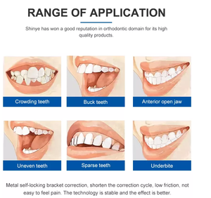 <span class=keywords><strong>Appareil</strong></span> orthodontique <span class=keywords><strong>dentaire</strong></span> professionnel pour l'alignement des dents / Gouttières d'alignement pour l'orthodontie - Product Image 5