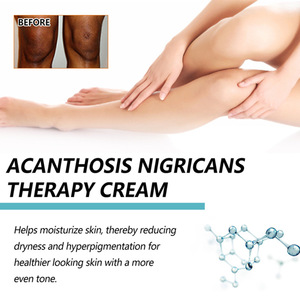 Crema Terapéutica para Acanthosis Nigricans de Marca Privada, 50g, para Espalda, Codos, Rodillas, Nudillos, Hidratante, Iluminadora y Exfoliante - Product Image 3
