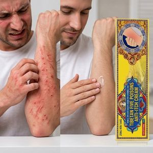 Baume Essentiel Apaisant Contre les Démangeaisons, Crème-Pommade Anti-Démangeaisons à Base de Plantes, OEM 20g <span class=keywords><strong>pour</strong></span> Irritations Cutanées et Piqûres d'Insectes, Dermatite, Eczéma, Herpès Fongique - Product Image 1