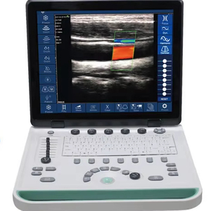 C5W 15inch 32/64 kênh LCD xách tay không dây kết nối tự do hoạt động máy tính xách tay siêu âm DOPPLER màu máy siêu âm - Product Image 1