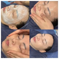 Lotion Exfoliante Visage Nettoyante en Profondeur 500g à la Vitamine E Naturelle pour Soin de la Peau, Effets Blanchissants, Élimination des Points Noirs et Points Blancs, Usage Professionnel en Salon