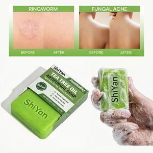 Custom Handmade Natural Herbal Tea Tree Oil <strong>Antibacterial</strong> Moisturizing Bar <strong>Soap</strong> <strong>for</strong> All Skin Types - Product Image 1