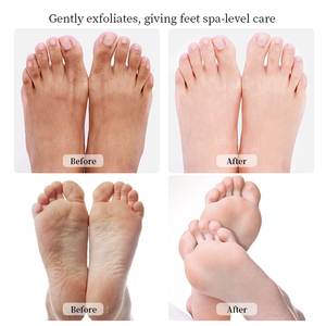 Etiqueta privada al por mayor cuidado de los pies hidratante exfoliante pedicura 4 pasos, remojo + exfoliante + máscara + crema - Product Image 4