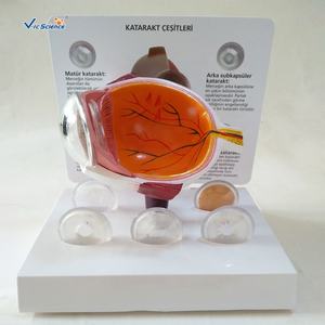 Modelo de Cataratas de Alta Calidad, Modelo de Glaucoma, Modelo de Ojo Patológico para Educación y Enseñanza. - Product Image 2