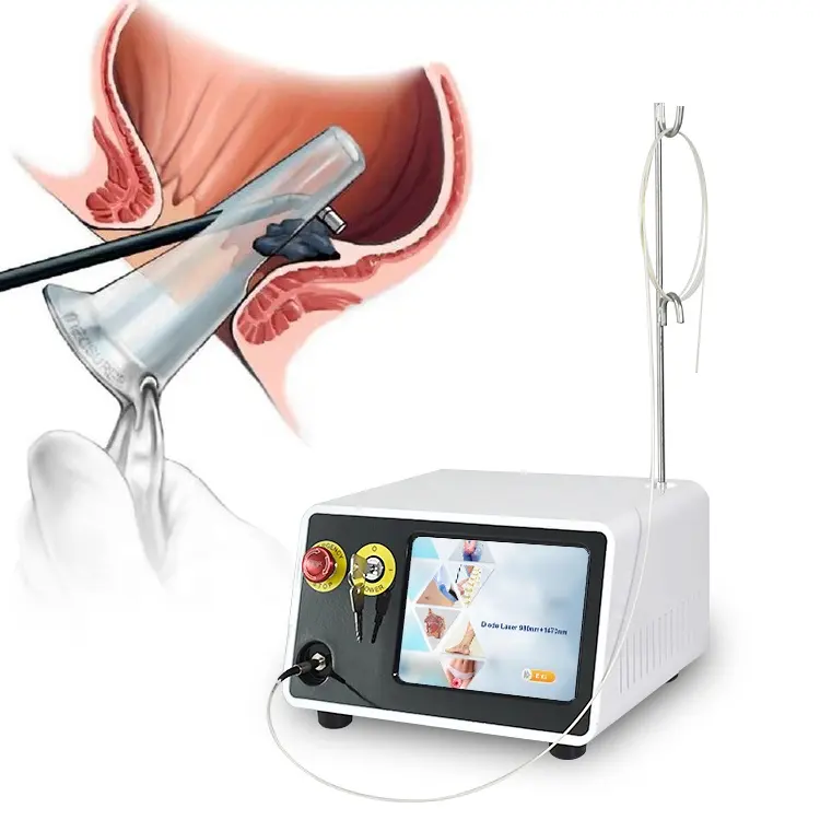 Arzt empfohlen Hämorrhoiden Anal Fistel Diode Laser behandlung Chirurgie Hämorrhoiden 980nm 1470nm Maschine