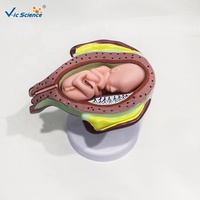 Modelo de Crecimiento Fetal Multietapa con Útero y Placenta, Ayuda de Entrenamiento Médico en Embriología para Escuelas de Obstetricia, CE/ISO/ROHS/CNAS