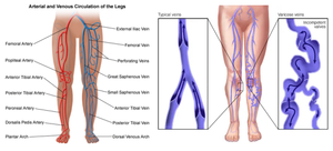 EVLT Láser Cirugía Vascular Sangre Vena Araña Eliminación 980nm 1470nm Endovascular Varicosa EVLA Ablación Médica Dispositivo Endovenoso - Product Image 3