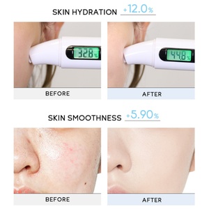 Limpiador Facial de 50g para el Cuidado de la Piel, Espuma Suave y Delicada de Bajo PH con Ácido Hialurónico, Reabastecedor de Hidratación, Venta al Por Mayor - Product Image 6