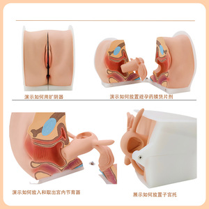 Modèle de Conseils sur la Contraception Féminine - Modèle Anatomique de Démonstration de l'<span class=keywords><strong>Insertion</strong></span> d'un DIU et de la Contraception - Product Image 4