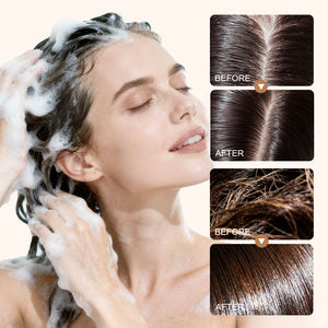 <span class=keywords><strong>Shampoing</strong></span> Solide Nettoyant en Profondeur pour Cheveux et <span class=keywords><strong>Cuir</strong></span> <span class=keywords><strong>Chevelu</strong></span> Gras, Formule Gingembre et Goudron de Pin, Biologique et Fait Main, Conception de Logo Gratuite - Product Image 3