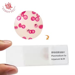 Биологические слайды с паразитами, слайды Plasmodium <span class=keywords><strong>Vivax</strong></span> Falciparum, Обучающие исследования, стеклянные слайды, подготовленные для лаборатории - Product Image 2