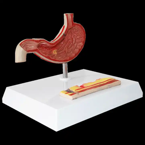 Equipo de enseñanza médica, ciencia médica, modelo de órgano humano patológico gástrico, modelo de anatomía, modelo de estómago - Product Image 6