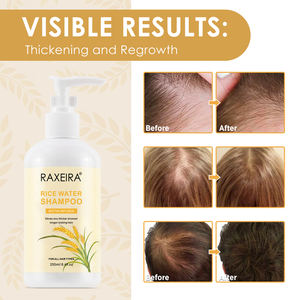 Productos <span class=keywords><strong>para</strong></span> el Cuidado del <span class=keywords><strong>Cabello</strong></span> al por Mayor, Champú Nutritivo <span class=keywords><strong>para</strong></span> el <span class=keywords><strong>Cabello</strong></span>, Champú de Agua de Arroz Anticaída, Champú Hidratante y Suavizante de Agua de Arroz, 250 ml - Product Image 6