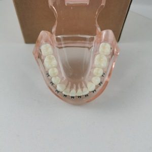 Modèle de démonstration dentaire M3001 avec bracket métallique, modèle anatomique en résine pour la science médicale et l'éducation MX-99 - Product Image 2