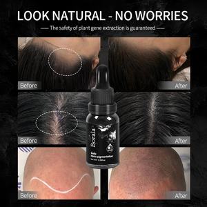 Ensemble d'encre SMP 15 ml à <span class=keywords><strong>prix</strong></span> d'usine, 4 couleurs - Pigment noir carbone pour tatouage capillaire et <span class=keywords><strong>micropigmentation</strong></span> du <span class=keywords><strong>cuir</strong></span> <span class=keywords><strong>chevelu</strong></span> - Product Image 6