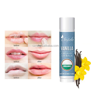 Set di Balsami <span class=keywords><strong>Labbra</strong></span> Naturali e Biologici con 6 Frutti, Burro di Karité, Miele, Mela e Cocco, Etichetta Privata OEM Personalizzata - Product Image 6