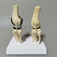 Modèle de prothèse de genou artificielle détachable KyrenMed, petit modèle d'implant de genou double argenté