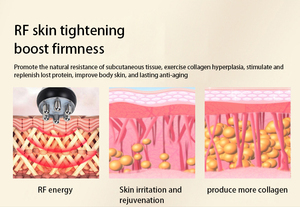 Appareil de beauté professionnel 9-en-1 pour le visage et le corps : Cible les cernes, les rides, la cellulite, la peau relâchée et les graisses localisées - Product Image 4